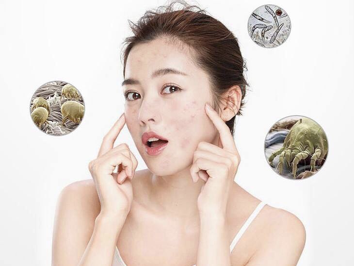 微塵、螨蟲、微生物